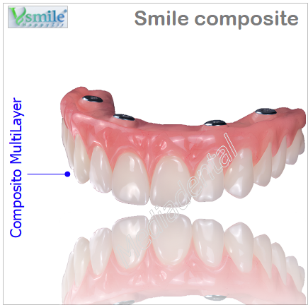Smile composite