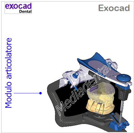 Exocad - immagine 5