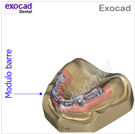 Exocad - immagine 3