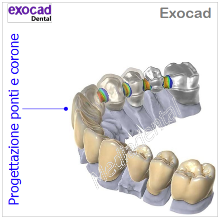 Exocad