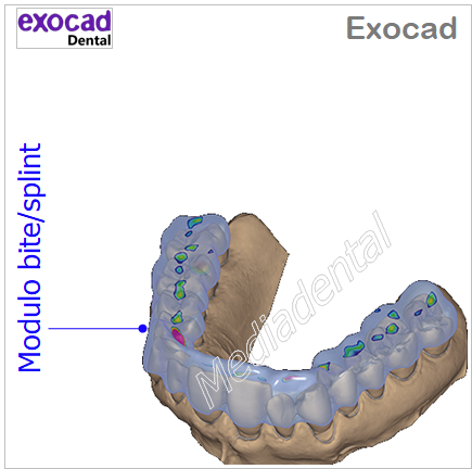 Exocad - immagine 6