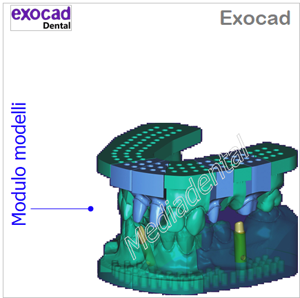 Exocad - immagine 7