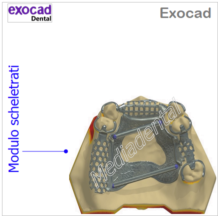 Exocad - immagine 8