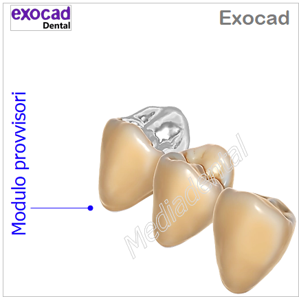 Exocad - immagine 9