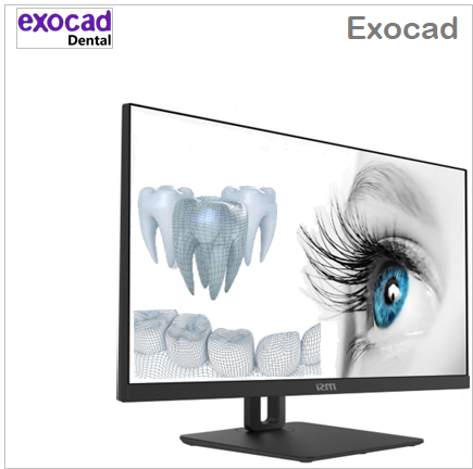 Exocad