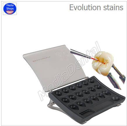Evolution stains