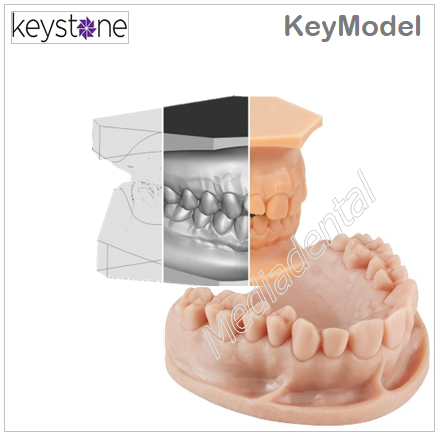 KeyModel
