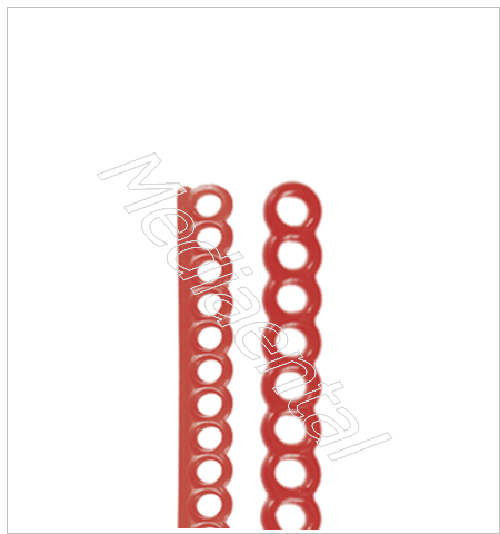 Ritenzioni ad anelli