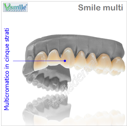 Smile multi
