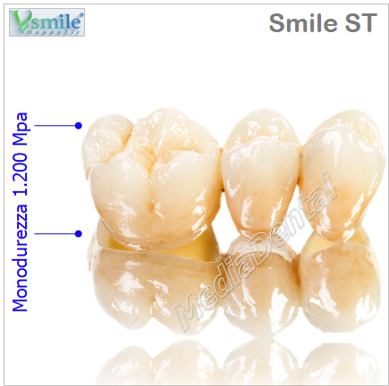 Smile ST