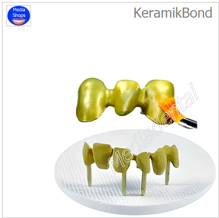KeramikBond