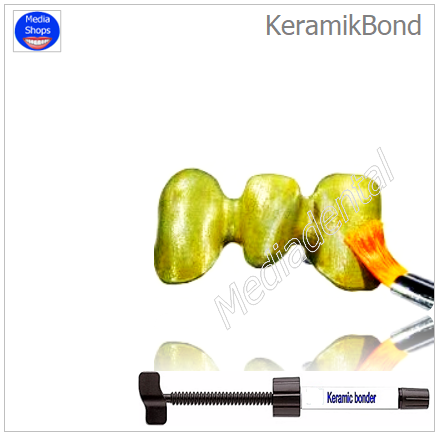 KeramikBond